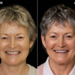 Anti aging 28 thumbnail