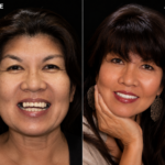 Anti aging 29 thumbnail