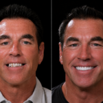 Anti Aging 30 thumbnail