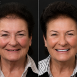 Anti Aging 34 thumbnail