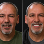 Anti Aging 36 thumbnail