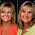 Anti Aging 38 thumbnail