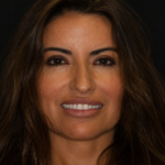 Andrea Smile Gallery 1 thumbnail