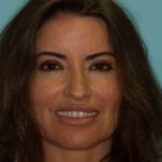 Andrea Smile Gallery 1 thumbnail