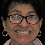 Smile Gallery 3/ Full Mouth Rehab 19 thumbnail