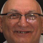 Smile Gallary 20/ Full Mouth Rehab 3 thumbnail