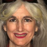 Smile Gallery 14/ Full Mouth Rehab 46 thumbnail