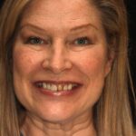 Smile Gallery 23 thumbnail