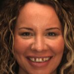 Smile Gallery 8 thumbnail