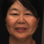 Smile gallery 19/ Full Mouth Rehab 2 thumbnail