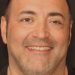 Smile Gallery 15/ Full Mouth Rehab 43 thumbnail