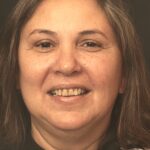 Smile Gallery 22 thumbnail