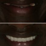 Implant Case 15 (No face) thumbnail