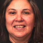 Smile Gallery 22 thumbnail