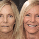 Anti aging 25 thumbnail