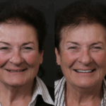 Anti Aging 34 thumbnail