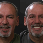 Anti Aging 36 thumbnail