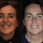 Anti aging 1 thumbnail