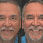 Anti Aging 11 thumbnail