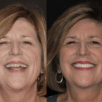 Anti Aging 13 thumbnail