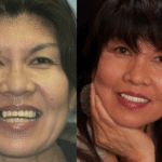 Anti aging 29 thumbnail