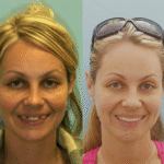 Implant Case 16 thumbnail