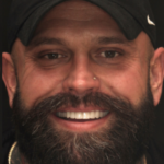 Smile Gallery 9/ Full Mouth Rehab 39 thumbnail
