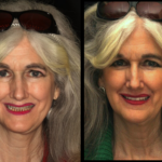 Anti Aging 7 thumbnail
