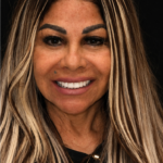 Smile Gallery 21/ Full Mouth Rehab 23 thumbnail