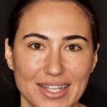 Smile Gallery 48 thumbnail