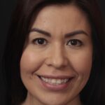 Veneer Case 44 thumbnail