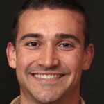 Veneer Case 23 thumbnail