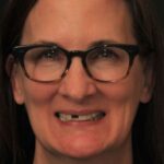 Smile Gallery 32 (Maybe)/ Full Mouth Rehab 32 thumbnail