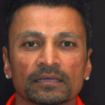 Smile Gallery Case 28 Maybe/ Full Mouth Rehab 22 thumbnail