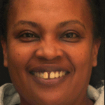 Smile Gallery 29 (Maybe) thumbnail