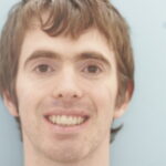 Veneer Case 47 thumbnail