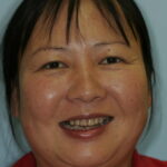 Smile Gallery 36 (Maybe) thumbnail