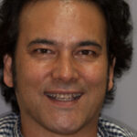 Smile Gallery 45 (Maybe) thumbnail