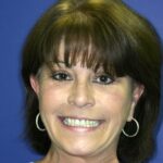 Veneer Case 18/ Crown Case 10 thumbnail