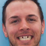 Smile Gallery 46 (Maybe) thumbnail