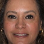 Smile Gallery 27 thumbnail