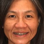 Smile Gallery 26 thumbnail