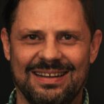 Smile Gallery 30 (Maybe)/ Full Mouth Rehab 31 thumbnail