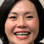 Veneer Case 27/ Full Mouth Rehab 39 thumbnail