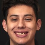 Smile Gallery 25 thumbnail