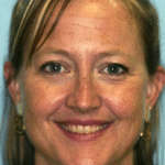 Veneer Case 6 thumbnail