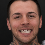 Smile Gallery 46 (Maybe) thumbnail
