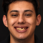 Smile Gallery 25 thumbnail