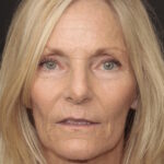 Full Mouth Rehab 27 thumbnail