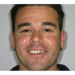 Bridge Case 5 thumbnail